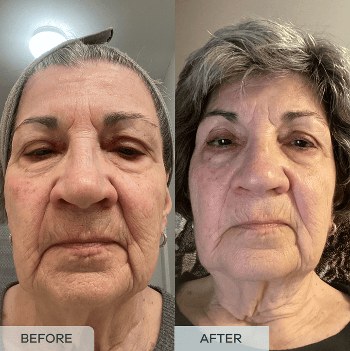 Love the results