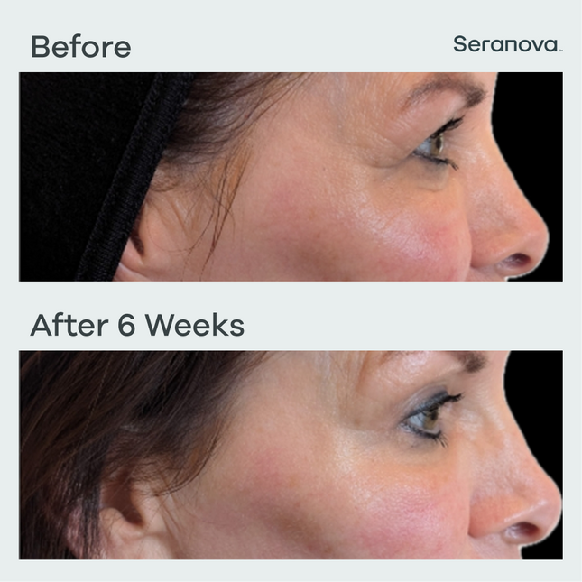 Customer before and after transformation