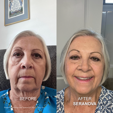 Seranova 