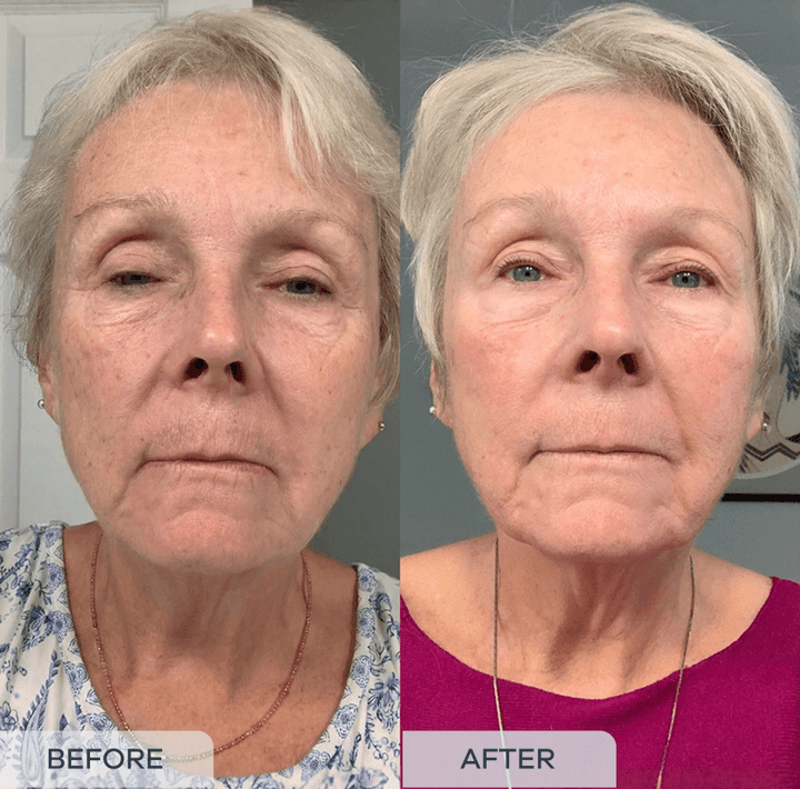 Aging Gracefully!