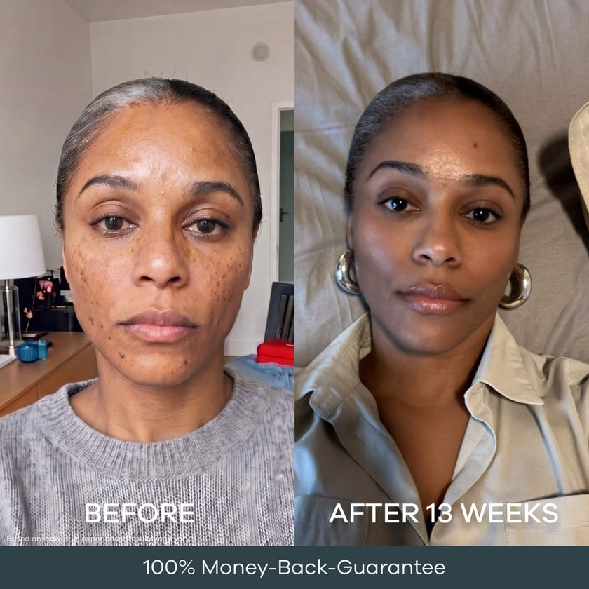 The Micro Infusion Pigmentation System™ - Seranova